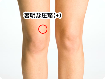 ganglion20191221-1.png