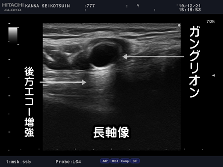 ganglion20191221-2.png