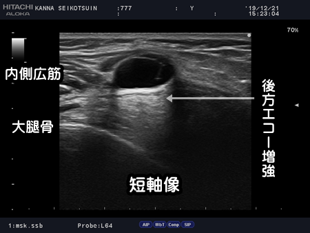 ganglion20191221-3.png